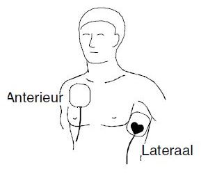 Physio-Control Lifepak 500/1000